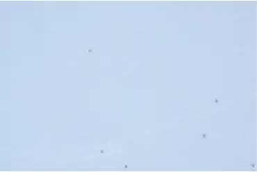 皮脂洗浄後_FPS-4710
